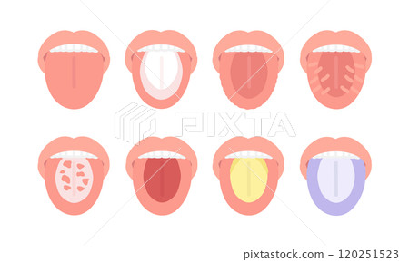 舌頭健康狀態類型插圖集 120251523
