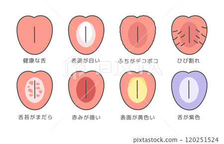 舌頭健康狀態類型插圖集（附說明） 120251524