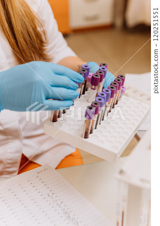 Lab technician organizing blood samples in test tubes for medical analysis and research 120251551