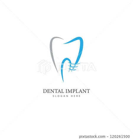 dental implant logo design concept vector  dental care logo template 120261500