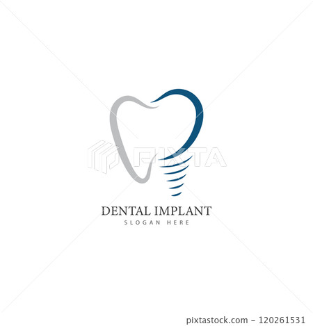 dental implant logo design concept vector  dental care logo template 120261531