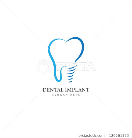 dental implant logo design concept vector  dental care logo template 120261533