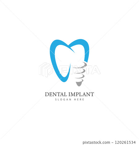 dental implant logo design concept vector  dental care logo template 120261534