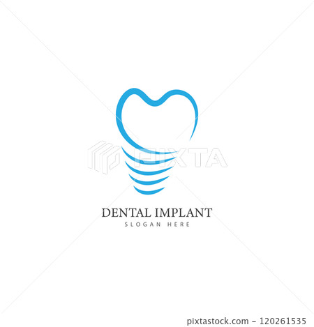 dental implant logo design concept vector  dental care logo template 120261535