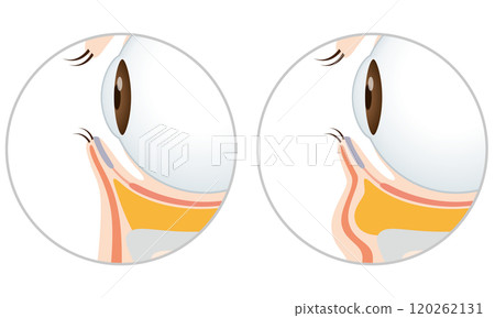 Sagging under the eyes: Firm eyes and sagging eyes 120262131