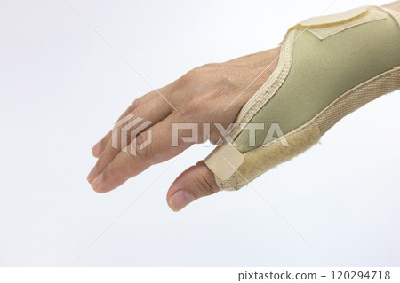 using Thumb Splints to treat De Quervain's Tenosynovitis using Thumb Splints to treat De Quervain's Tenosynovitis 120294718