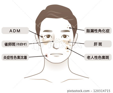 Middle-aged men, age spots, name, beauty, aging 120314715