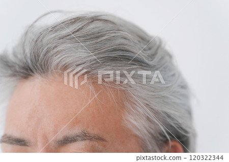 Hairline enhancement for senior men 120322344