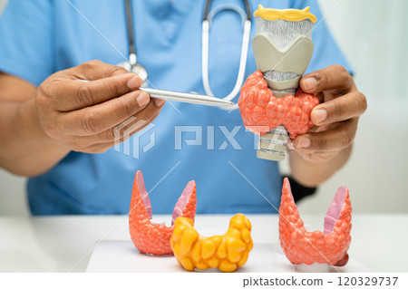 Hyperthyroidism, Overactive Thyroid, Thyroid Lymphoma, Asian doctor with thyroid gland human anatomy model in hospital. 120329737