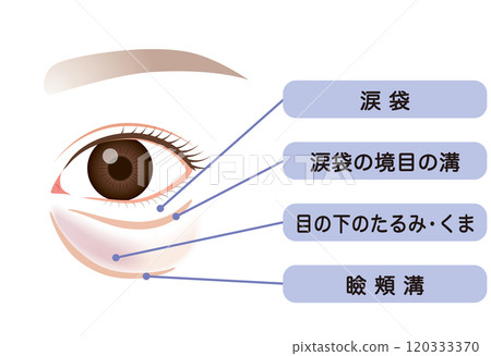 眼袋、下眼瞼下垂 120333370