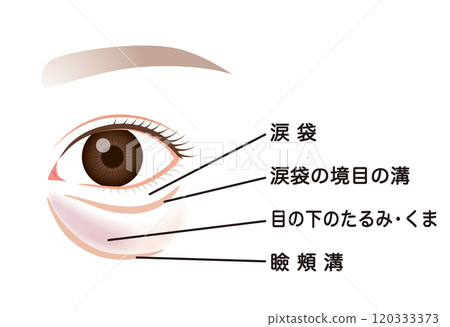 眼袋、下眼瞼下垂 120333373