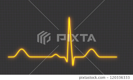 Normal heart rhythm ECG electrocardiogram of a healthy person, heart examination method 120336333
