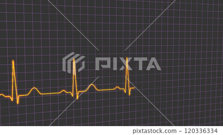 Normal heart rhythm ECG electrocardiogram of a healthy person, heart examination method 120336334