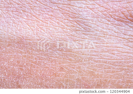 dry and dehydrated human skin texture background dry and dehydrated human skin texture background 120344904