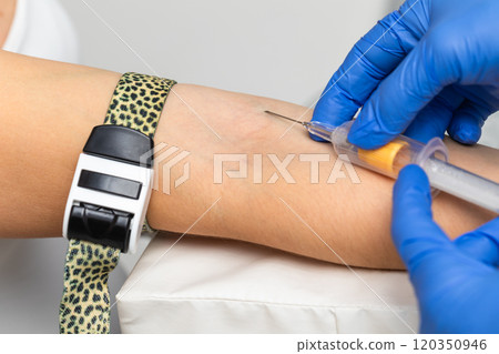 Nurse taking a blood sample from a patients arm 120350946