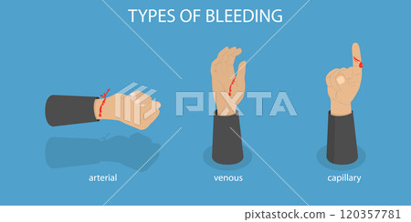 3D Isometric Flat Vector Illustration of Types Of Bleeding, Human Hands with Different Wounds 3D Isometric Flat Vector Illustration of Types Of Bleeding, Human Hands with Different Wounds 120357781