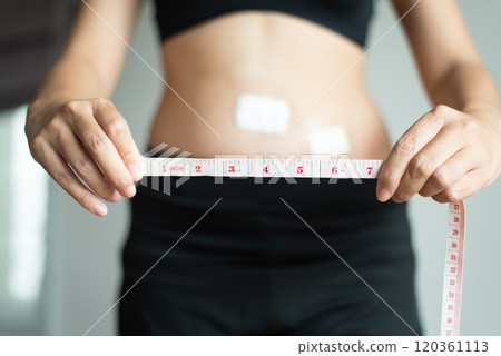 Patient woman hands holding measuring tape for measure size wound after surgery on white background 120361113