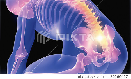 Visual representation of low back pain: An embodied image of pain and discomfort in the lumbar area. Visual representation of low back pain: An embodied image of pain and discomfort in the lumbar area. 120366427