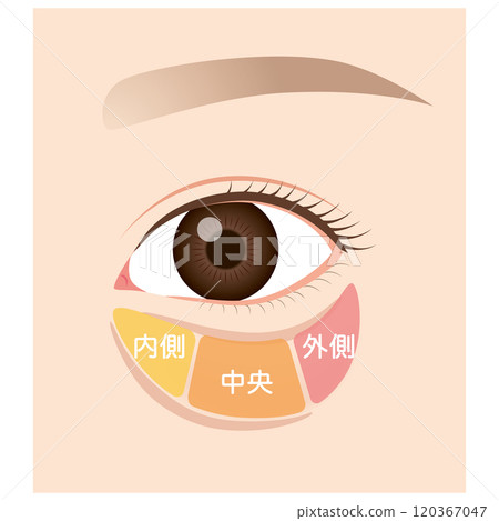 眼眶脂肪、眼袋、下眼瞼下垂 眼眶脂肪、眼袋、下眼瞼下垂 120367047