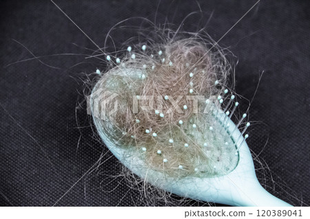 Concept of problem with hair. Comb with hair loss on dark background 120389041