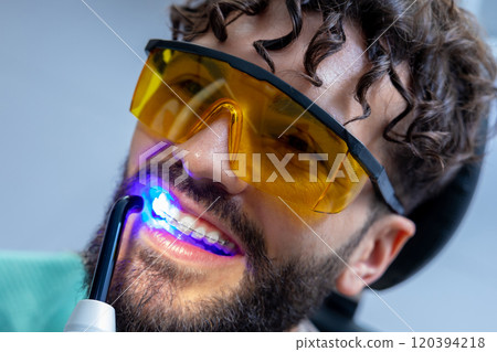 Man in protective glasses having teeth whitening by dental UV whitening device Man in protective glasses having teeth whitening by dental UV whitening device 120394218