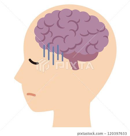 腦部壓力/疲勞 腦部壓力/疲勞 120397633