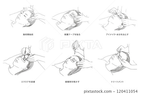 睫毛嫁接睫毛治療流程 睫毛嫁接睫毛治療流程 120411054