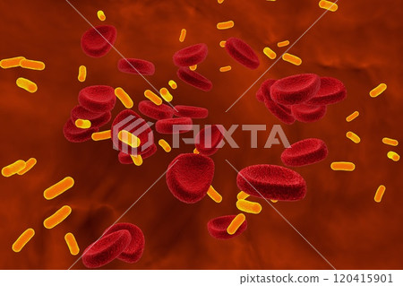 Bacteria in blood, bacteriemia Bacteria in blood, bacteriemia 120415901