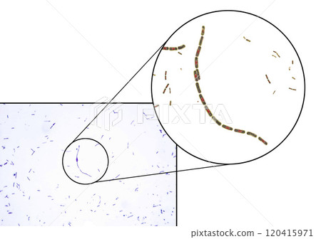 Bacteria Bacillus anthracis 120415971