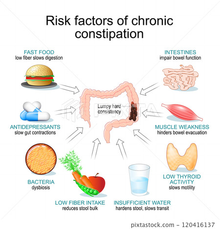 Chronic constipation. 120416137