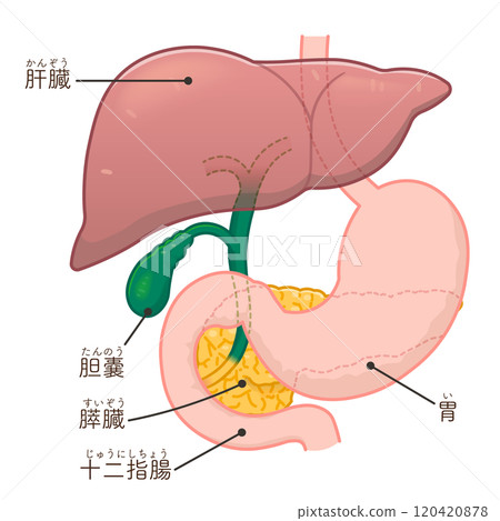膽汁引流插圖，膽汁引流 120420878