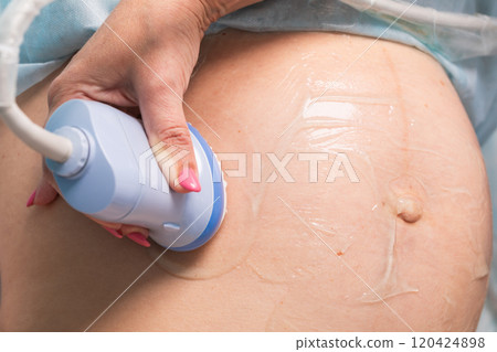 Close-up of medical ultrasound procedure on a pregnant womans belly 120424898