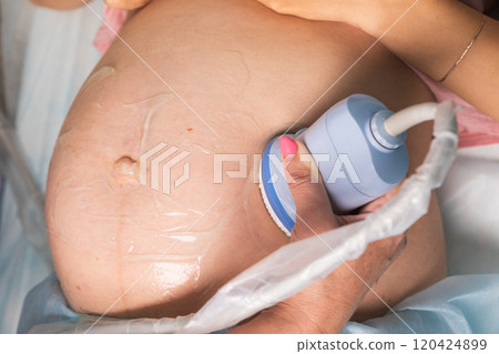 Close-up of an ultrasound probe on a pregnant belly during a prenatal scan 120424899