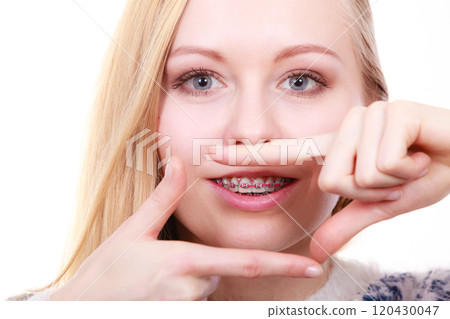 Happy woman showing her braces on teeth Happy woman showing her braces on teeth 120430047
