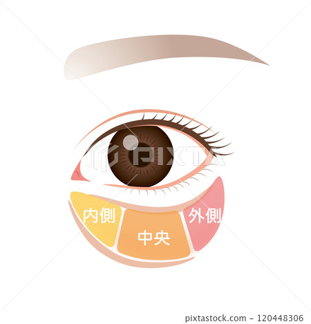 眼眶脂肪、眼袋、下眼瞼下垂 眼眶脂肪、眼袋、下眼瞼下垂 120448306