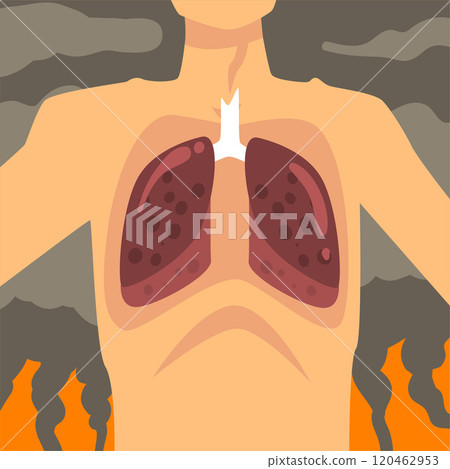 Human Lungs, People Suffering from Industrial Smog, Respiratory Disease from Industry Air Pollution, Vector Illustration Human Lungs, People Suffering from Industrial Smog, Respiratory Disease from Industry Air Pollution, Vector Illustration 120462953