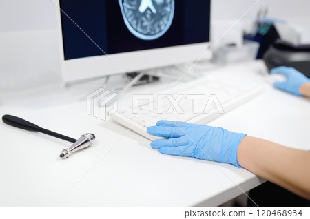 Neurologist is at an appointment in office of modern clinic. Doctor sitting at desk and studying an X-ray of human brain. There is neurological hammer nearby to check reflexes. 120468934
