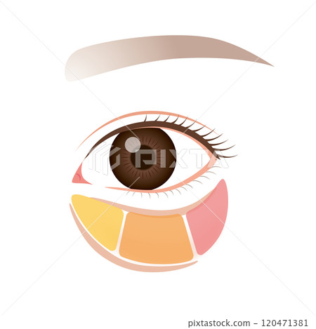 Orbital fat, bags under the eyes, sagging lower eyelids 120471381