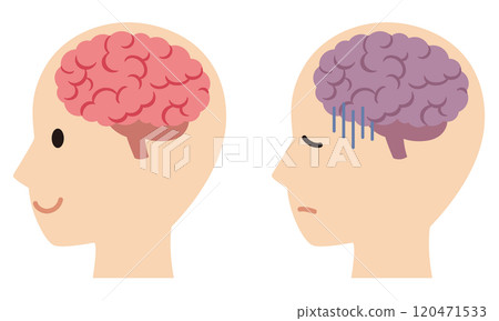 Healthy brain and stressed brain Brain image Health Healthy brain and stressed brain Brain image Health 120471533
