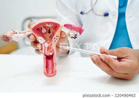 Uterus, doctor holding human anatomy model for study diagnosis and treatment in hospital. 120490462