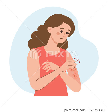 Woman scratches her hand. Allergic itching, skin inflammation, redness and irritation. Atopic dermatitis, eczema, psoriasis. Healthcare and medicine. Woman scratches her hand. Allergic itching, skin inflammation, redness and irritation. Atopic dermatitis, eczema, psoriasis. Healthcare and medicine. 120493313