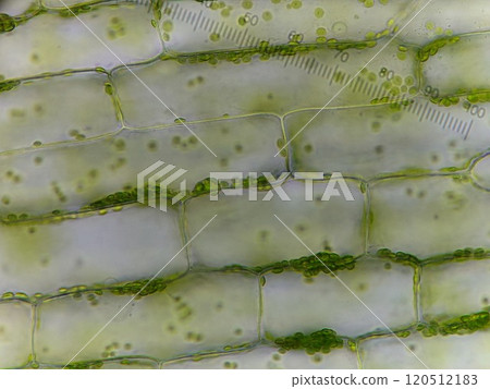 加拿大巨型蜘蛛的血漿流 120512183