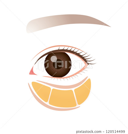 眼眶脂肪、眼袋、下眼瞼下垂 眼眶脂肪、眼袋、下眼瞼下垂 120514499