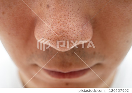 Strawberry nose close-up: pores and blackheads of a man in his 30s 120537992