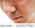 Strawberry nose close-up: pores and blackheads of a man in his 30s 120537993