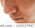 Strawberry nose close-up: pores and blackheads of a man in his 30s 120537997