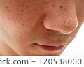 Strawberry nose close-up: pores and blackheads of a man in his 30s 120538000