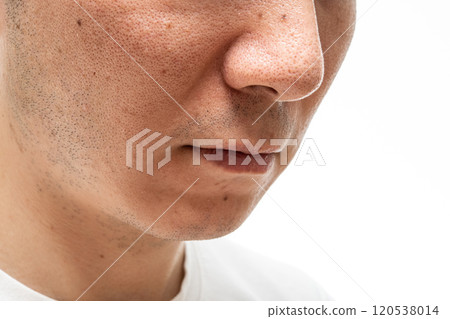 Strawberry nose close-up: pores and blackheads of a man in his 30s 120538014
