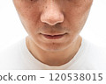 Strawberry nose close-up: pores and blackheads of a man in his 30s 120538015