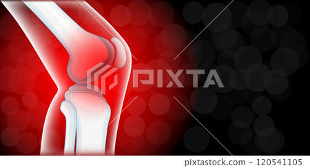 Knee joint pain. 120541105